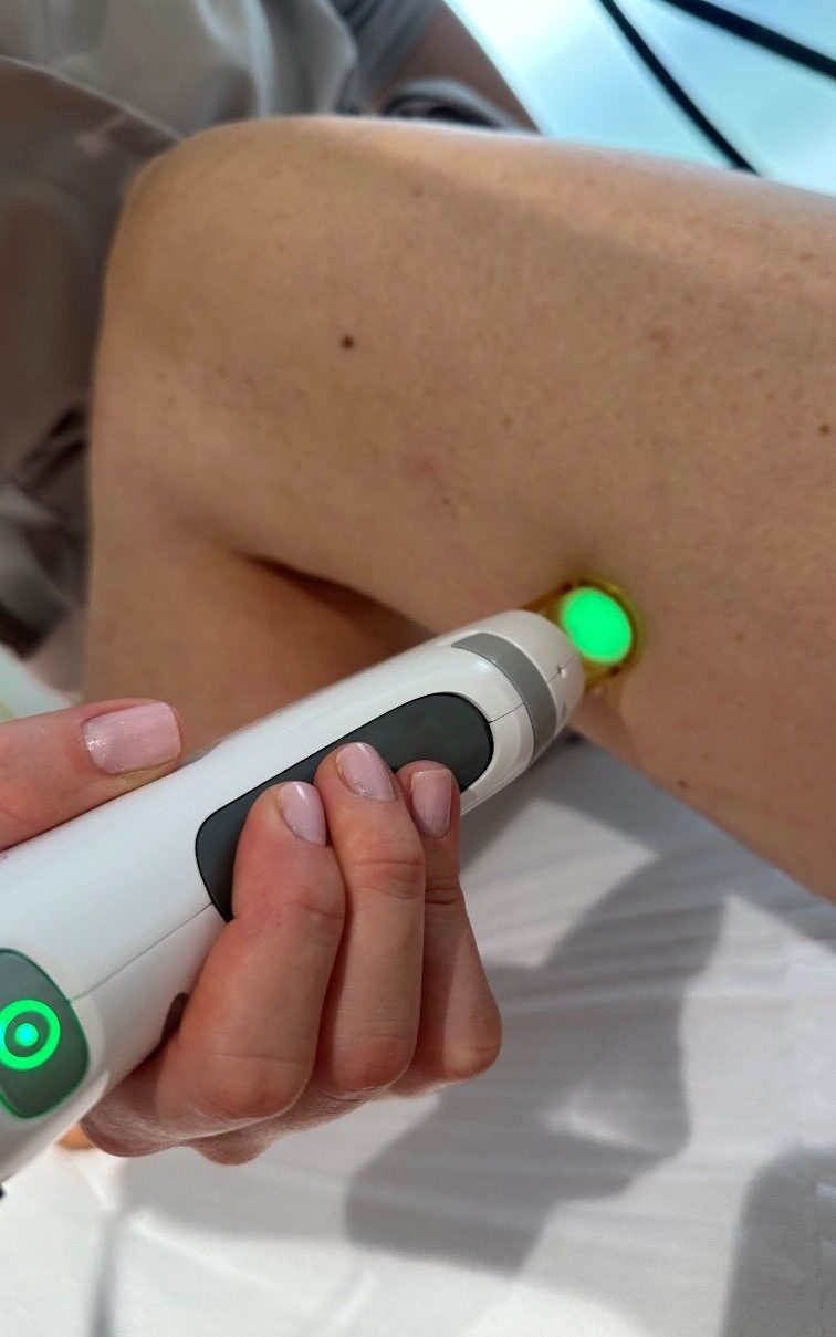 novemed-oferta-zabiegi-depilacja-laserowa-urzadzenie-przy-zabiegu-01