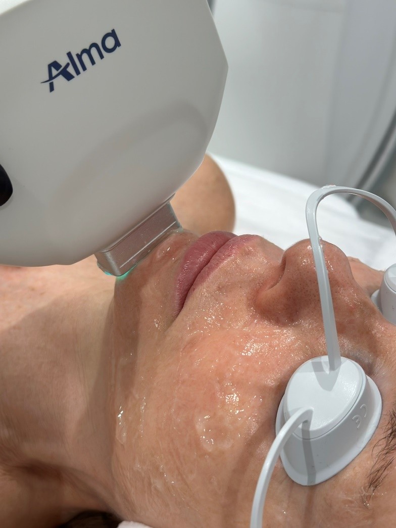 novemed-zabiegi-laseroterapia-alma-harmony-zabieg-01